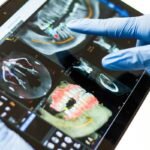 Coverage Limit Repatriation Dental Plan High: 7 Proven Ways to Avoid Costly Surprises