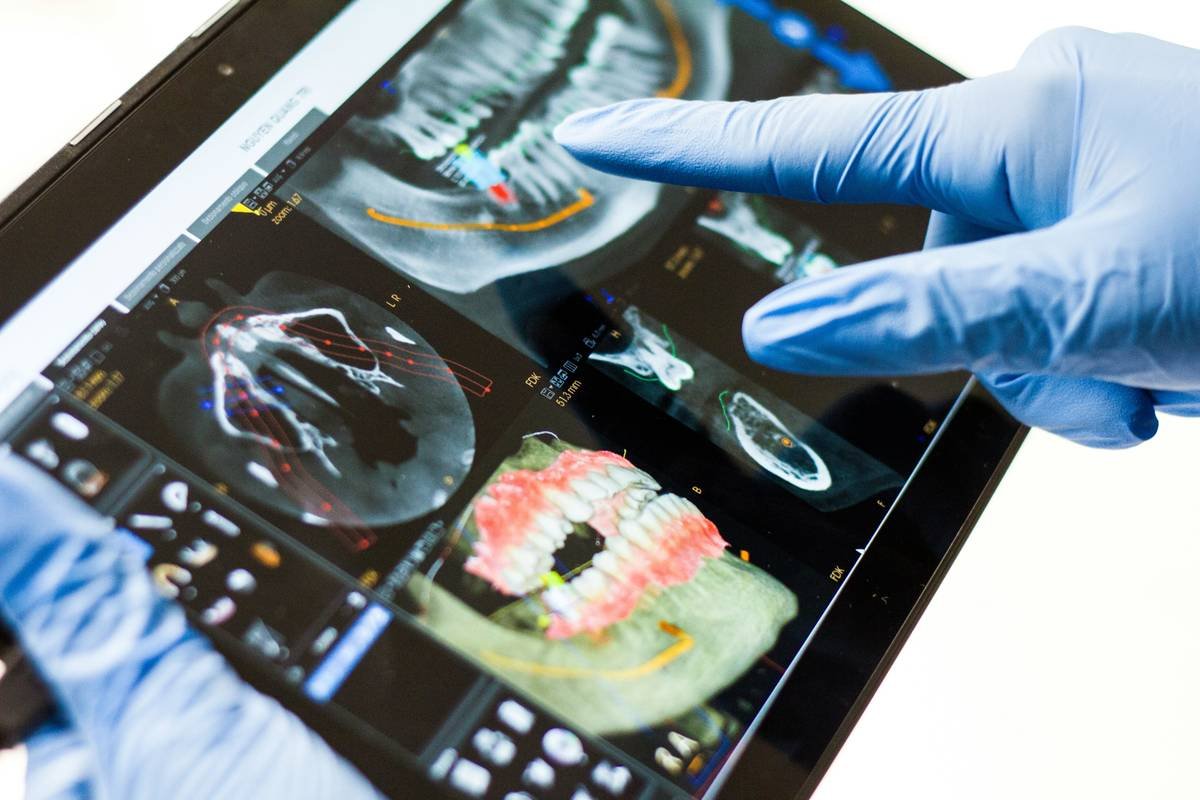Coverage Limit Repatriation Dental Plan High: 7 Proven Ways to Avoid Costly Surprises